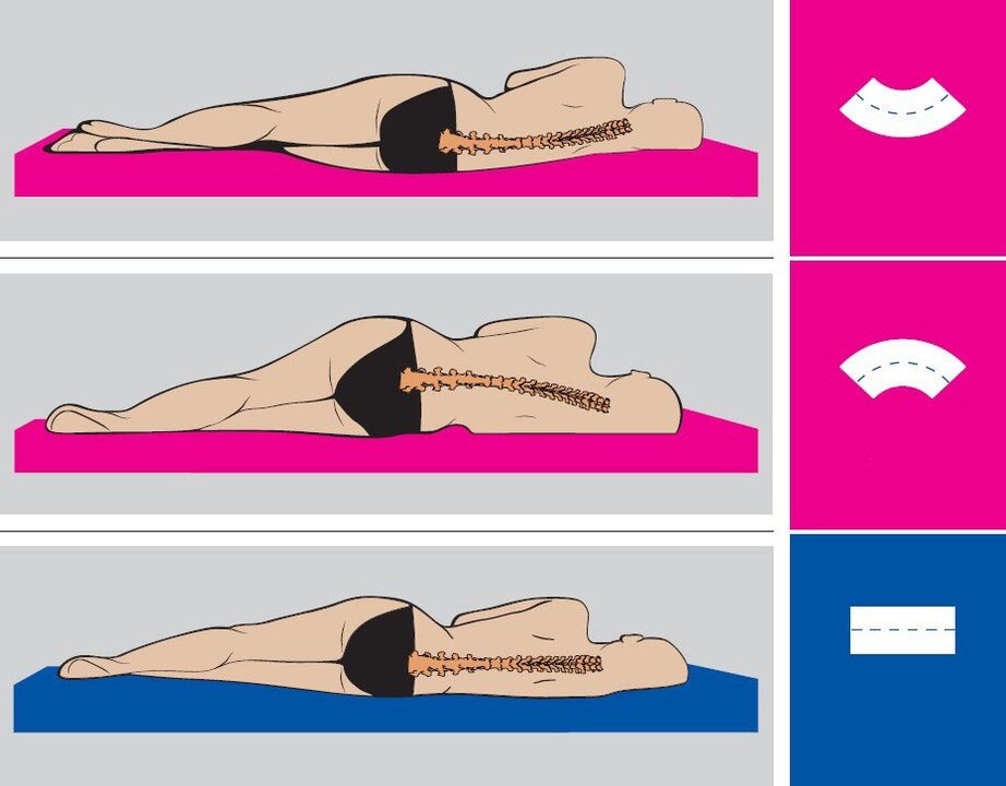 Správná poloha těla během spánku s bederní osteochondrózou