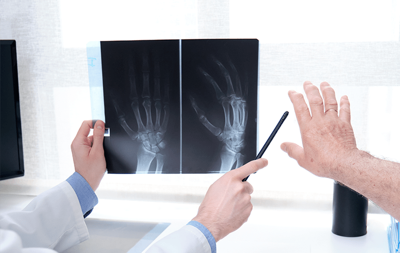 diagnostika kloubní artrózy